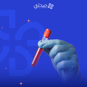 تحاليل الروكتان